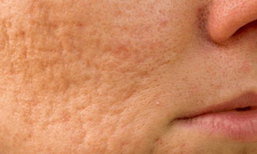 DERMA 3. REGENERACIÓN