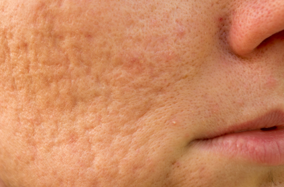 DERMA 3. REGENERACIÓN