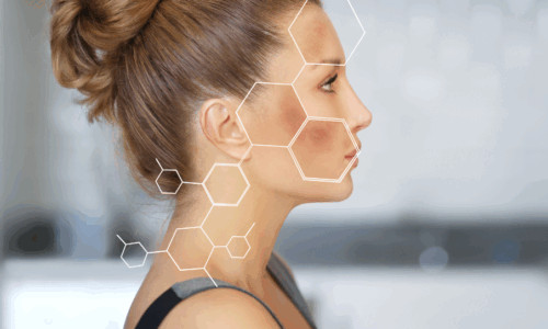 DERMA 5. VITAMINA C Y DESPIGMENTACIÓN